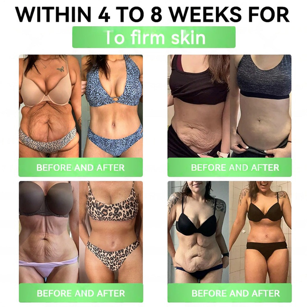 𝑶𝒏𝒍𝒊𝒏𝒆 𝑷𝒉𝒂𝒓𝒎𝒂𝒄𝒚 | 🇬🇧🏥 𝐏𝐄𝐀𝐊𝐀® 𝑮𝑳𝑷-𝟏 𝐒𝐢𝐱-𝐢𝐧-𝐎𝐧𝐞 𝗦𝗹𝗶𝗺 & 𝑯𝒆𝒂𝒍𝒕𝒉 𝑶𝒓𝒂𝒍 𝑺𝒐𝒍𝒖𝒕𝒊𝒐𝒏 (𝑂𝑛𝑐𝑒 𝑎 𝑑𝑎𝑦, 𝑣𝑖𝑠𝑖𝑏𝑙𝑒 𝑟𝑒𝑠𝑢𝑙𝑡𝑠 𝑖𝑛 7 𝑑𝑎𝑦𝑠) ✅𝗦𝘂𝗽𝗽𝗼𝗿𝘁𝘀 𝗼𝗯𝗲𝘀𝗶𝘁𝘆, 𝗰𝗮𝗿𝗱𝗶𝗼𝘃𝗮𝘀𝗰𝘂𝗹𝗮𝗿 𝗵𝗲𝗮𝗹𝘁𝗵, 𝗱𝗶𝗮𝗯𝗲𝘁𝗲𝘀, 𝘀𝗹𝗲𝗲𝗽 𝗮𝗽𝗻𝗲𝗮, 𝗴𝘂𝘁 𝗵𝗲𝗮𝗹𝘁𝗵, 𝗷𝗼𝗶𝗻𝘁 𝗶𝘀𝘀𝘂𝗲𝘀, 𝐰𝐡𝐢𝐥𝐞 𝐚𝐥𝐬𝐨 𝐟𝐢𝐫𝐦𝐢𝐧𝐠 𝐭𝐡𝐞 𝐬𝐤𝐢𝐧 𝐚𝐧𝐝 𝐛𝐨𝐨𝐬𝐭𝐢𝐧𝐠 𝐞𝐧𝐞𝐫𝐠💪