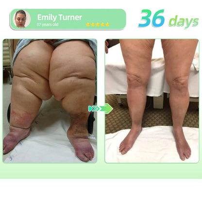 𝐕𝐢𝐬𝐢𝐛𝐥𝐞 𝐑𝐞𝐬𝐮𝐥𝐭𝐬 𝐢𝐧 𝟕 𝐃𝐚𝐲𝐬✅| PEAKA® 𝗘𝗳𝗳𝗲𝗿𝘃𝗲𝘀𝗰𝗲𝗻𝘁 𝗧𝗮𝗯𝗹𝗲𝘁𝘀- 🌿 𝑂𝑏𝑒𝑠𝑖𝑡𝑦 𝐶𝑎𝑟𝑑𝑖𝑜𝑣𝑎𝑠𝑐𝑢𝑙𝑎𝑟 𝐷𝑖𝑠𝑒𝑎𝑠 𝐷𝑖𝑎𝑏𝑒𝑡𝑒𝑠 𝑆𝑙𝑒𝑒𝑝 𝐴𝑝𝑛𝑒𝑎 𝐽𝑜𝑖𝑛𝑡 𝑃𝑟𝑜𝑏𝑙𝑒𝑚𝑠 𝑎𝑛𝑑 𝑀𝑜𝑟𝑒